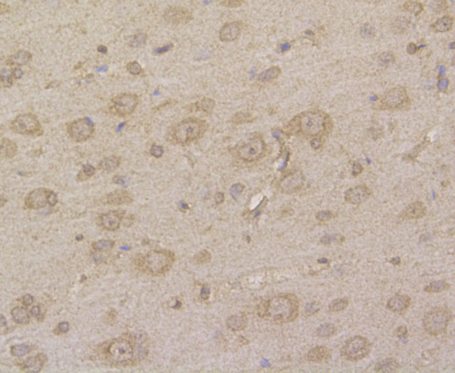 HIP1 Antibody in Immunohistochemistry (Paraffin) (IHC (P))