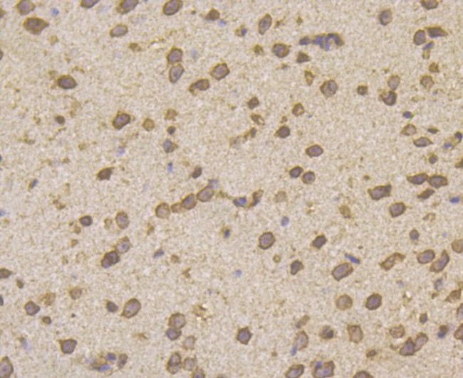 HIP1 Antibody in Immunohistochemistry (Paraffin) (IHC (P))