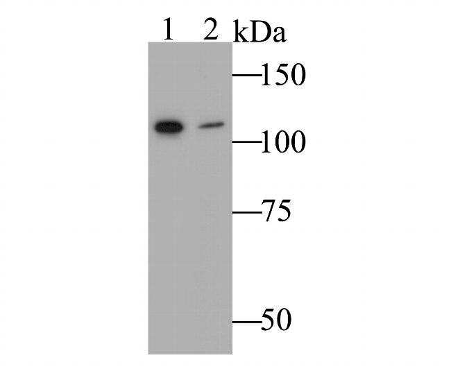 HIP1 Antibody in Western Blot (WB)