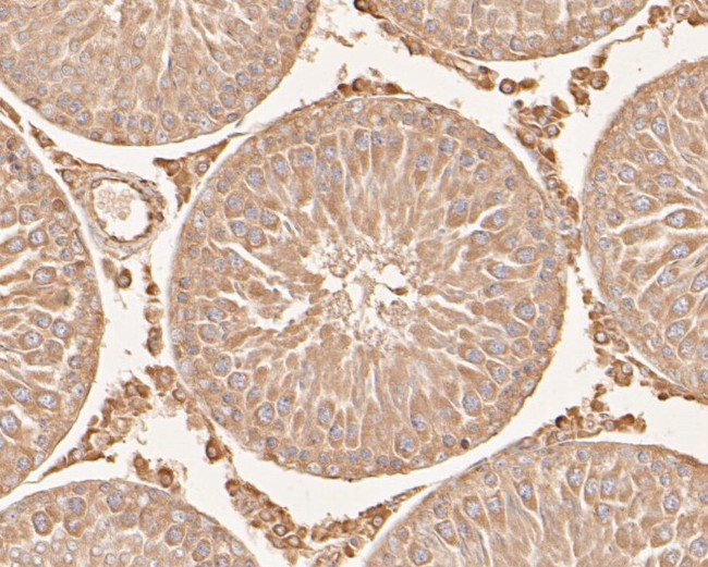 SERPINC1 Antibody in Immunohistochemistry (Paraffin) (IHC (P))