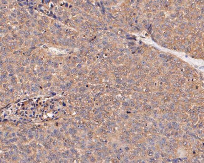 SERPINC1 Antibody in Immunohistochemistry (Paraffin) (IHC (P))