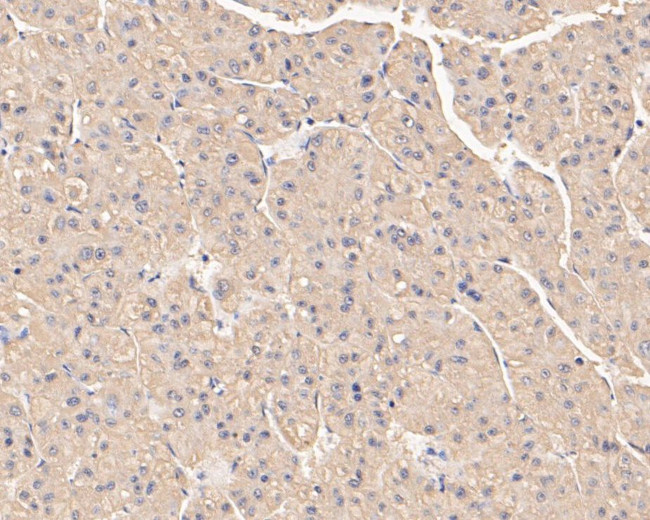 SERPINC1 Antibody in Immunohistochemistry (Paraffin) (IHC (P))