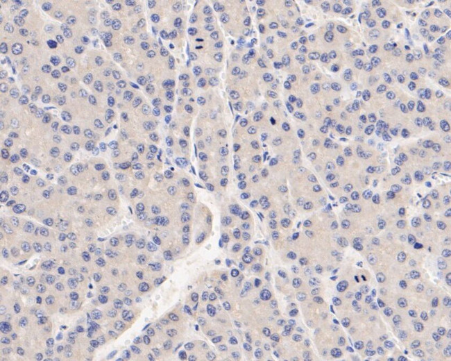 SERPINC1 Antibody in Immunohistochemistry (Paraffin) (IHC (P))