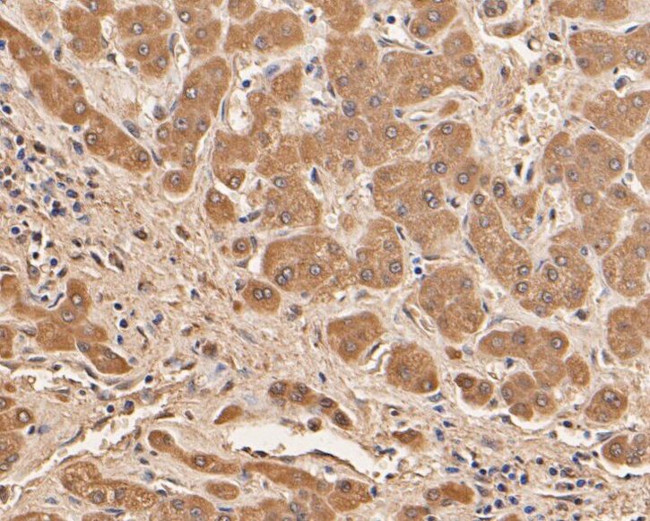 SERPINC1 Antibody in Immunohistochemistry (Paraffin) (IHC (P))