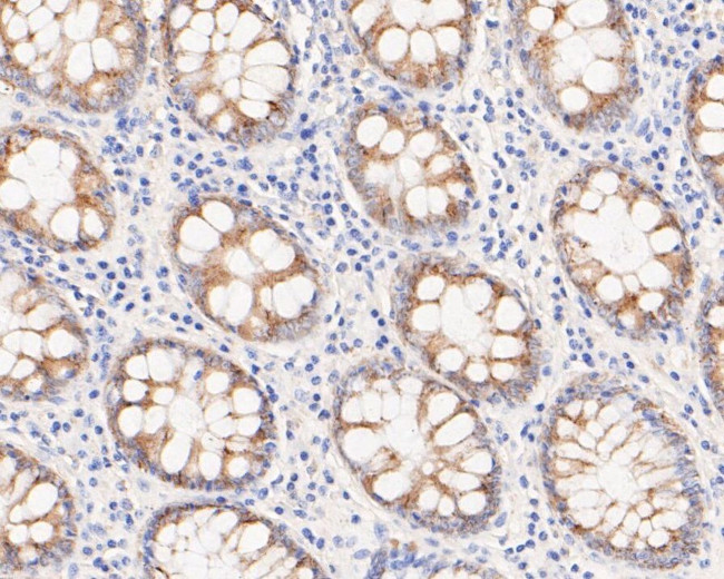 MGST1 Antibody in Immunohistochemistry (Paraffin) (IHC (P))