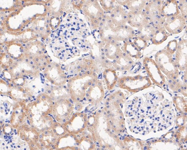 MGST1 Antibody in Immunohistochemistry (Paraffin) (IHC (P))