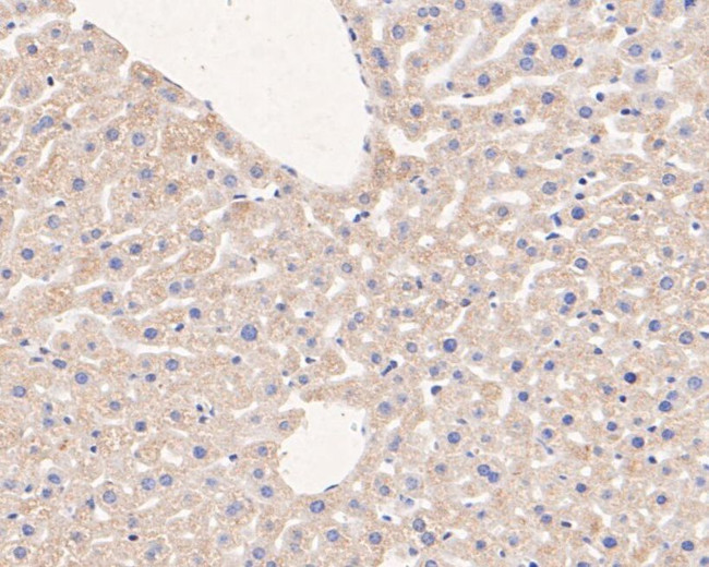 MGST1 Antibody in Immunohistochemistry (Paraffin) (IHC (P))