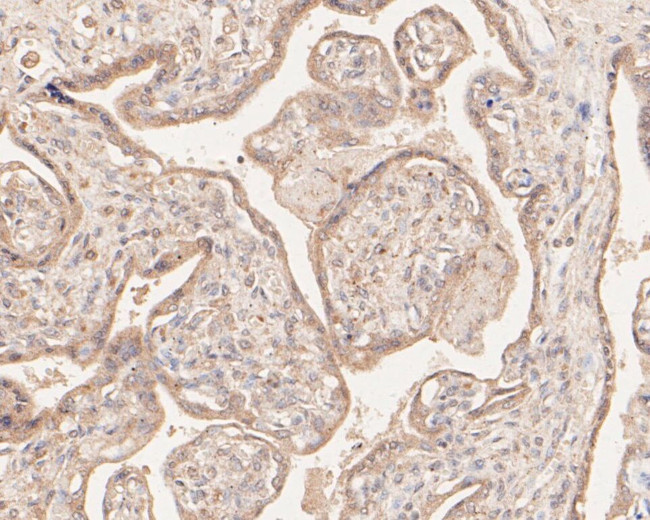 MGST1 Antibody in Immunohistochemistry (Paraffin) (IHC (P))