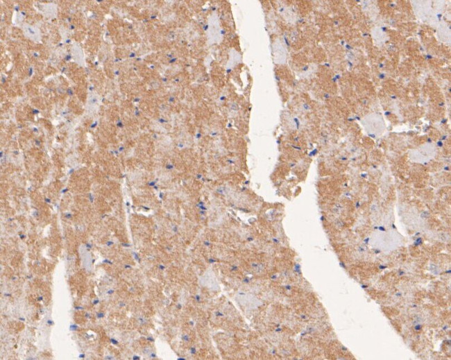 USP21 Antibody in Immunohistochemistry (Paraffin) (IHC (P))