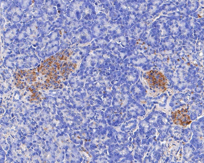 TRIM72 Antibody in Immunohistochemistry (Paraffin) (IHC (P))