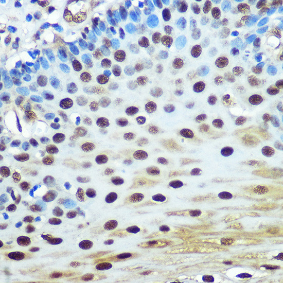 hnRNP K Antibody in Immunohistochemistry (Paraffin) (IHC (P))