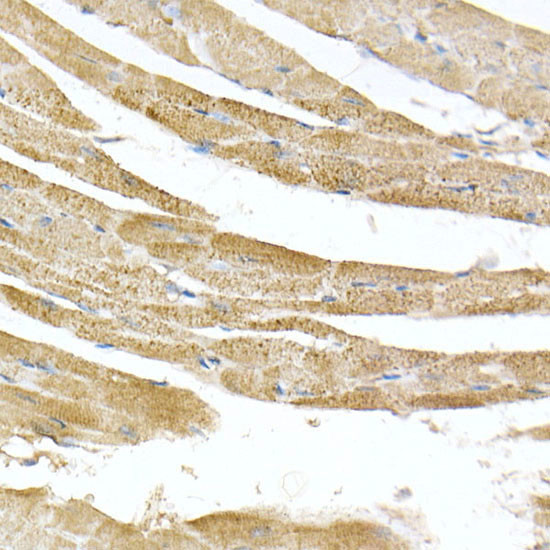 ATP Synthase beta Antibody in Immunohistochemistry (Paraffin) (IHC (P))