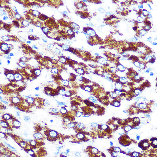 SERPINC1 Antibody in Immunohistochemistry (Paraffin) (IHC (P))