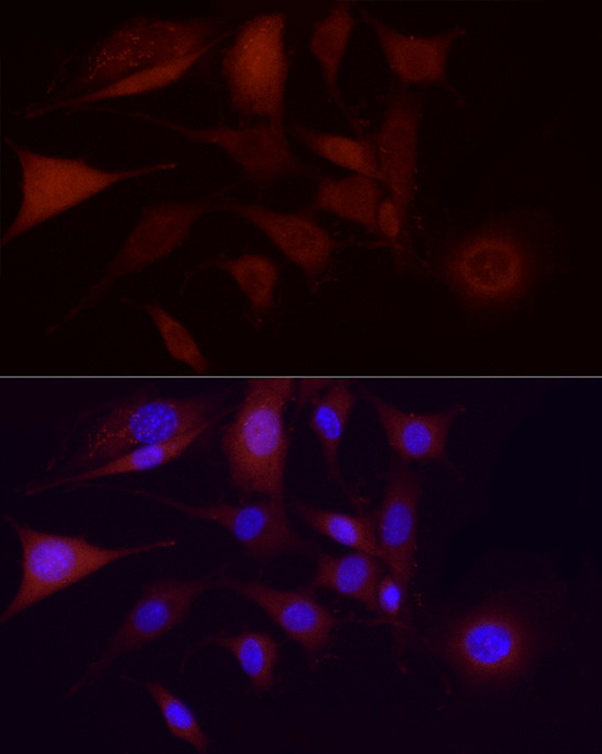 CDK1 Antibody in Immunocytochemistry (ICC/IF)