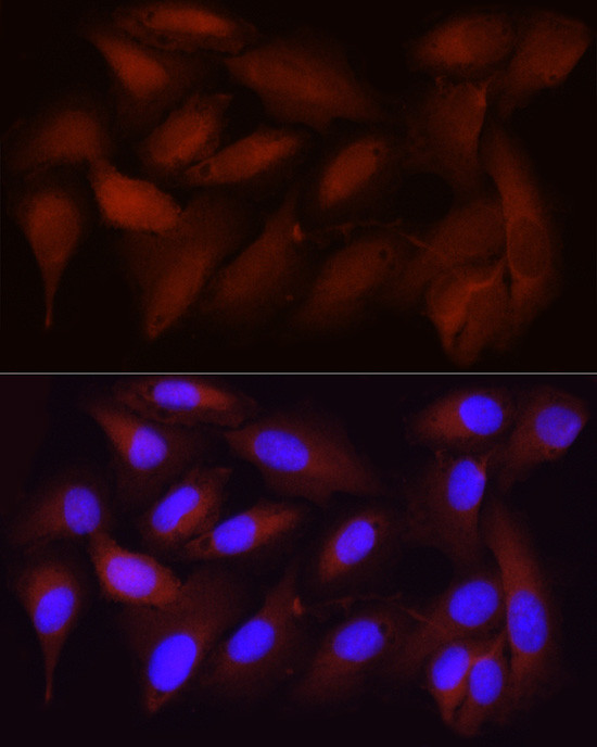 CDK1 Antibody in Immunocytochemistry (ICC/IF)