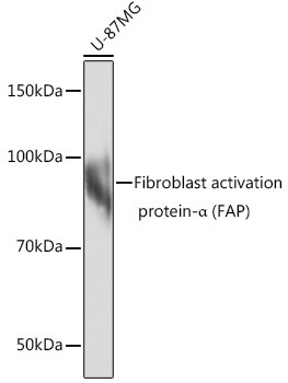 FAP Antibody in Western Blot (WB)