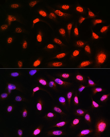 VCP Antibody in Immunocytochemistry (ICC/IF)