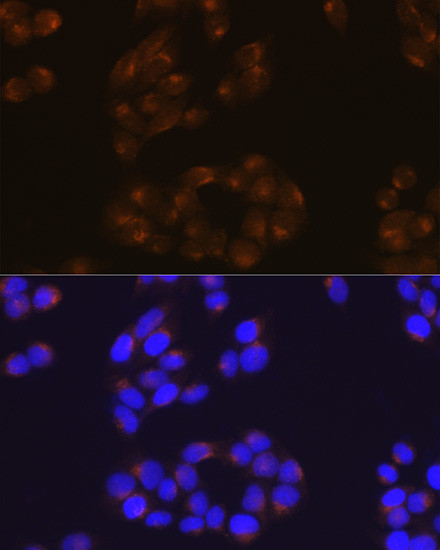 Amyloid Precursor Protein Antibody in Immunocytochemistry (ICC/IF)