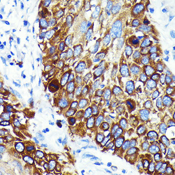 Cathepsin B Antibody in Immunohistochemistry (Paraffin) (IHC (P))