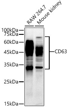 CD63 Antibody in Western Blot (WB)