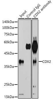 CDX2 Antibody in Immunoprecipitation (IP)
