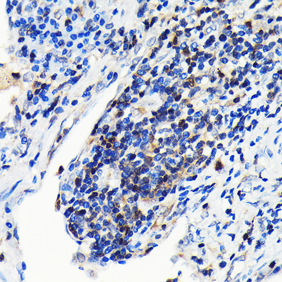 GRB2 Antibody in Immunohistochemistry (Paraffin) (IHC (P))