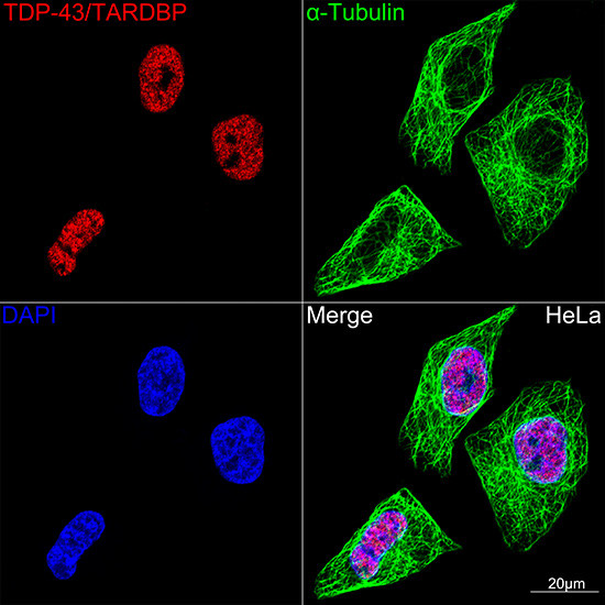 TDP-43 Antibody in Immunocytochemistry (ICC/IF)