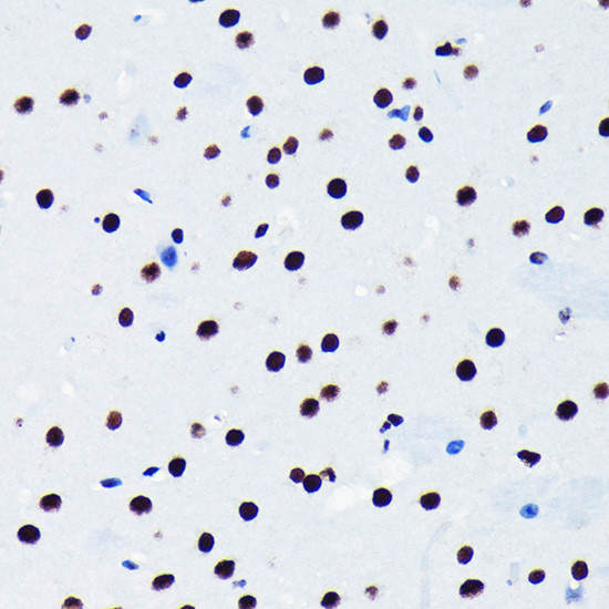 TDP-43 Antibody in Immunohistochemistry (Paraffin) (IHC (P))