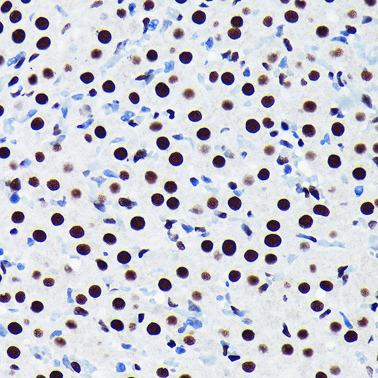 TDP-43 Antibody in Immunohistochemistry (Paraffin) (IHC (P))