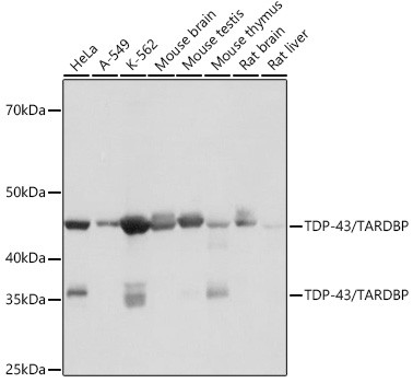 TDP-43 Antibody in Western Blot (WB)