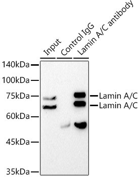 Lamin A/C Recombinant Monoclonal Antibody (4L8Q0) (MA5-35284)