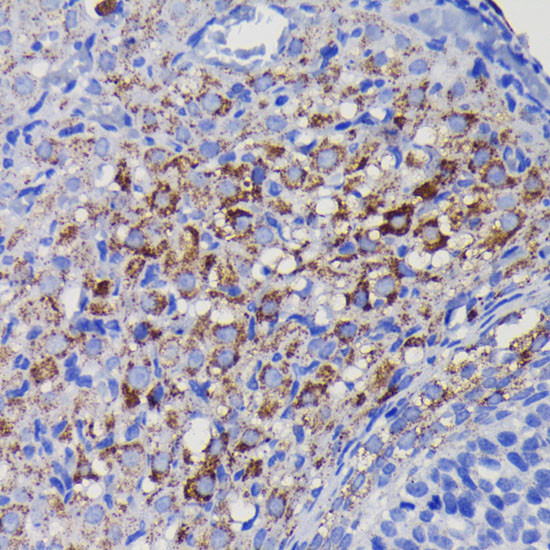 SOD2 Antibody in Immunohistochemistry (Paraffin) (IHC (P))