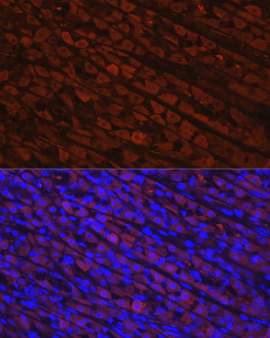 NQO1 Antibody in Immunohistochemistry (Paraffin) (IHC (P))