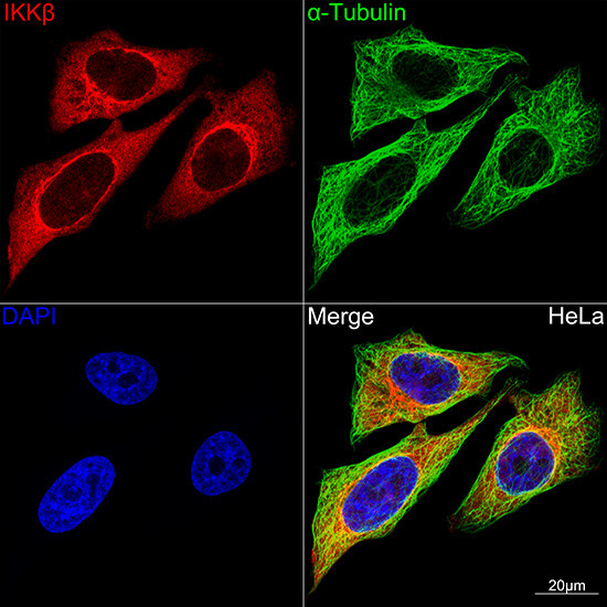 IKK beta Antibody in Immunocytochemistry (ICC/IF)