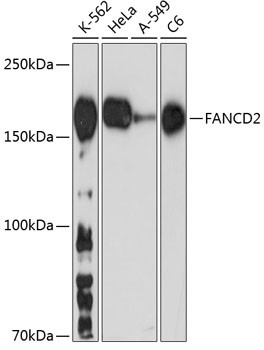 FANCD2 Antibody in Western Blot (WB)