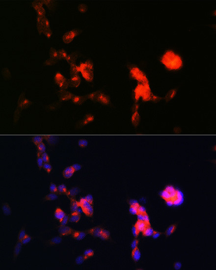 DKK3 Antibody in Immunocytochemistry (ICC/IF)