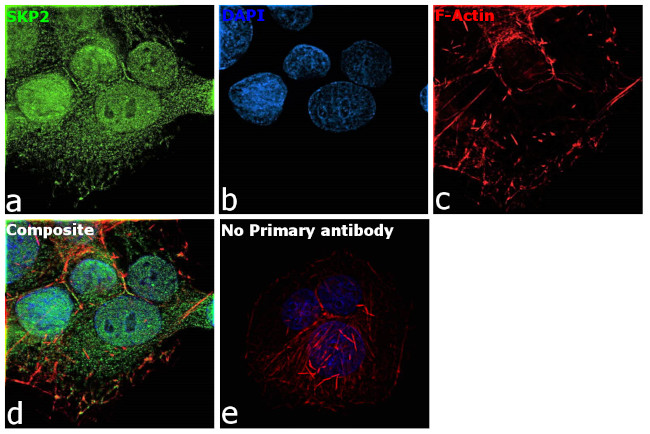 SKP2 Antibody in Immunocytochemistry (ICC/IF)