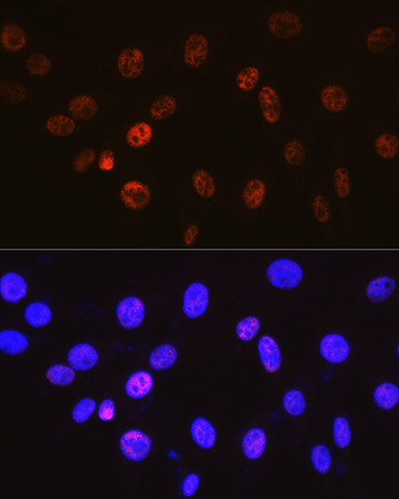 Cyclin H Antibody in Immunocytochemistry (ICC/IF)