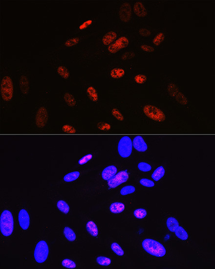 Cyclin H Antibody in Immunocytochemistry (ICC/IF)