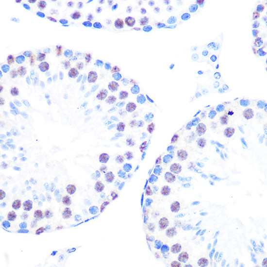 Cyclin H Antibody in Immunohistochemistry (Paraffin) (IHC (P))