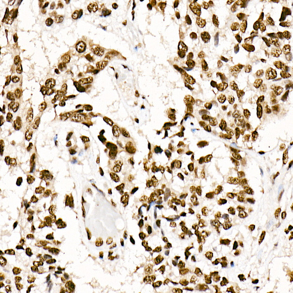 SRSF1 Antibody in Immunohistochemistry (Paraffin) (IHC (P))