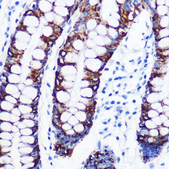 MAOA Antibody in Immunohistochemistry (Paraffin) (IHC (P))