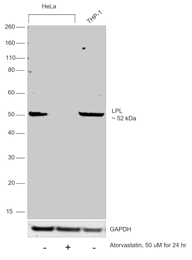 LPL Antibody in Western Blot (WB)