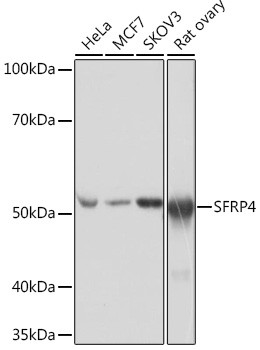 SFRP4 Antibody in Western Blot (WB)