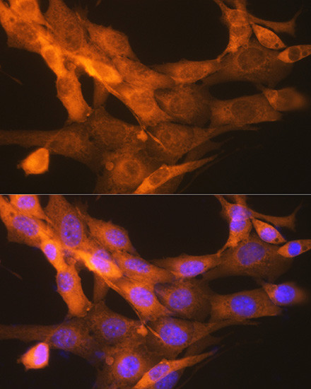 tPA Antibody in Immunocytochemistry (ICC/IF)