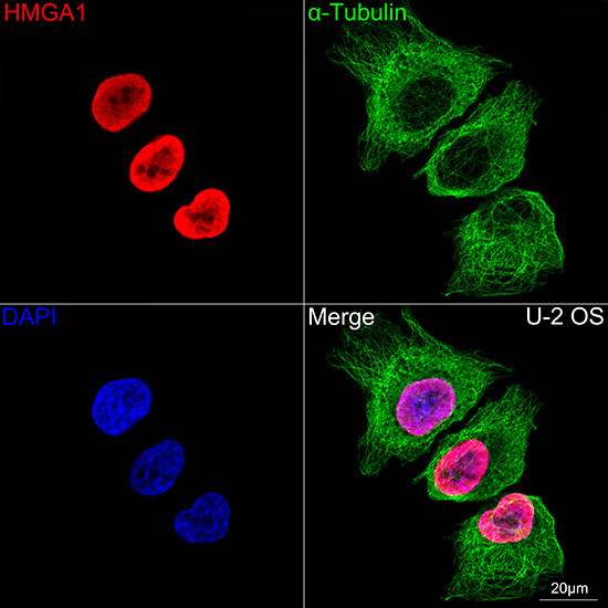 HMGA1 Antibody in Immunocytochemistry (ICC/IF)