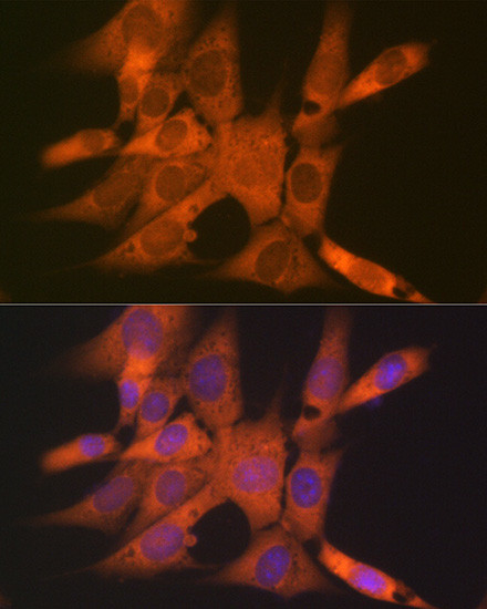 Tetranectin Antibody in Immunocytochemistry (ICC/IF)