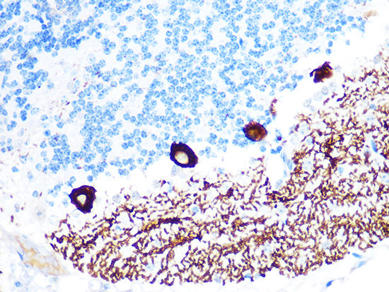 IP3 Receptor 1 Antibody in Immunohistochemistry (Paraffin) (IHC (P))