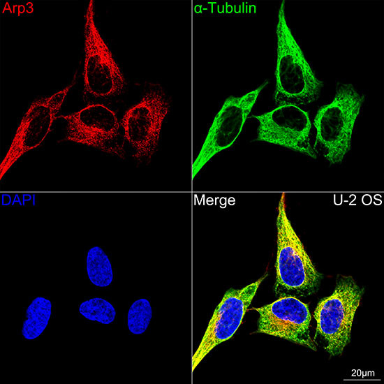 Arp3 Antibody in Immunocytochemistry (ICC/IF)