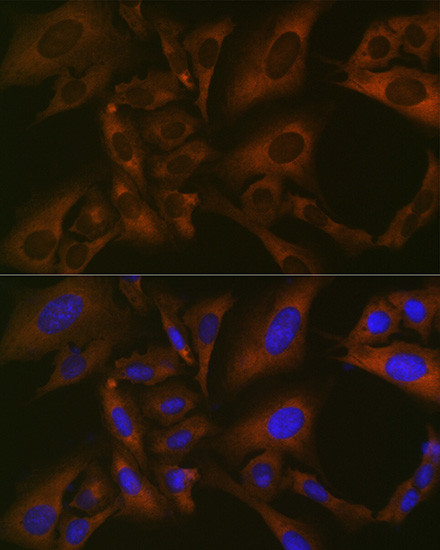 BMP6 Antibody in Immunocytochemistry (ICC/IF)